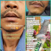 Gambar Natura Beauty Spray 100% original ( 1paket=7botol) dari Elen NaturaWorld undefined 3 Tokopedia