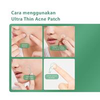 Gambar ACNAWAY Ultra Thin Acne Patch/Acnaway Acne patch/Stiker Jerawat/Sticker Jerawat/Penutup Jerawat/Plester jerawat dari Elobelle Beauty ID undefined 5 Tokopedia