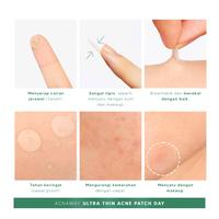 Gambar ACNAWAY Ultra Thin Acne Patch/Acnaway Acne patch/Stiker Jerawat/Sticker Jerawat/Penutup Jerawat/Plester jerawat dari Elobelle Beauty ID undefined 4 Tokopedia