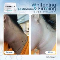 Gambar MS GLOW WHITENING & FIRMING NECK CREAM - neck+roller dari trahma_shop1 undefined 3 Tokopedia