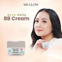 Gambar Daily Krim Acne BB Cream Krim Wajah Siang Untuk Muka Berjerawat dari MS Glow By Intan undefined 1 Tokopedia