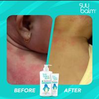 Gambar Suubalm Suu Balm Kids Kid 45ml Untuk Kulit Kering Gatal Eksim Sensitif dari C2F SHOP undefined 3 Tokopedia