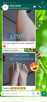 Gambar Obat gatal selangkangan dan buah zakar paling ampuh asli di Apotik dari Tabib Herbal Tradisional undefined 5 Tokopedia