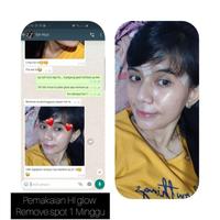 Gambar PAKET CUSTOME PERMIUM AC1/AC2/AC3/AC4/N1/ACNE SENSITIF/W1/W2/W3 - AC4 dari Central skincare indonesia undefined 4 Tokopedia
