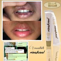 Gambar B ERL ADVANCE LIP TREATMENT / Lipstik Treatment / Lip balm / Pelembab dari BELFASHOP com undefined 3 Tokopedia