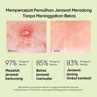 Gambar Skintific Salicylic Acid Acne Spot Treatment Gel 10gr dari Kalarismu Beauty Store undefined 4 Tokopedia