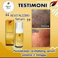 Gambar serum bopeng dan pori pori besar dari AmanahSR12pusat undefined 4 Tokopedia