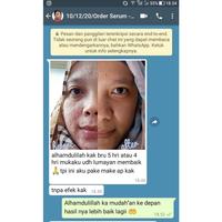 Gambar Adera Serum Oryginal 100% BPOM Brightening / Acne / Darkspot - Darkspot dari NASA AMANAH STORE#06 undefined 4 Tokopedia