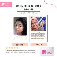Gambar FAST DERM PAKET ACNE GLOWING BASIC FREE POUCH & GIFT dari Fast Derm. Official Shop undefined 4 Tokopedia