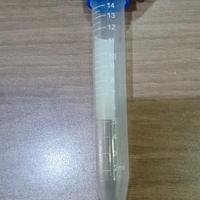 Gambar tabung konikel plastik tutup biru15 ml / tabung centrifuge plastik dari CV. ENDRA MEDIKA MAKMUR undefined 1 Tokopedia