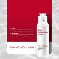 Gambar (LIVE) ElsheSkin  Cleansing Wash - 100ml Salicylic Acid ( Bersihkan Rawat Kulit Berjerawat Tanpa Iritasi) - Sabun Cuci Muka Jerawat Membersihkan Wajah , Facial Mencerahkan Berminyak Hitam Pencerah Perawatan  viral   cleanser Aging Mengencangkan dari Elsheskin undefined 5 Tokopedia