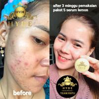 Gambar hyde beauty skincare glowing original isi 3 dari ALIFA AZZAHRA undefined 5 Tokopedia
