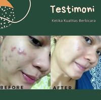 Gambar Masker Spirulina penghilang jerawat dan bekas jerawat - 30 kaps SEGEL dari Haecare undefined 5 Tokopedia