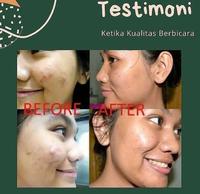 Gambar Masker Spirulina penghilang jerawat dan bekas jerawat - 30 kaps SEGEL dari Haecare undefined 3 Tokopedia