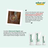 Gambar Metcovazin Reguler 25gr dari Asonstore_NEW undefined 4 Tokopedia