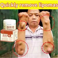 Gambar Obat Benjolan Tubuh Krim Tumor Jinak Salep Lipoma ORIGNAL Ampuh Obat dari girast undefined 3 Tokopedia