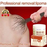 Gambar Obat Benjolan Tubuh Krim Tumor Jinak Salep Lipoma ORIGNAL Ampuh Obat dari girast undefined 1 Tokopedia