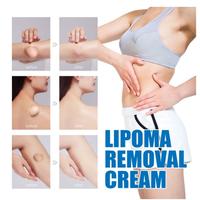 Gambar Obat Benjolan Tubuh Krim Tumor Jinak Salep Lipoma ORIGNAL Ampuh Obat dari girast undefined 4 Tokopedia