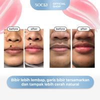 Gambar Vita C Lip Essence dari Soera Skin undefined 4 Tokopedia