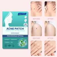 Gambar ( BUNDLE) Acne Patch Jerawat / Acne Treatment 108 Pcs - with Tea Tree dari Super Plaster undefined 3 Tokopedia