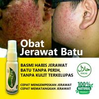 Gambar Obat Jerawat Batu Spray - Dermazits 25ml dari kozozo undefined 1 Tokopedia