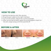 Gambar Soft Cauter Alat Penghilang Black Spot Tatto Kutil Flek Melasma Cauter dari NATURA LOVE undefined 3 Tokopedia