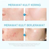 Gambar SKINTIFIC - Gel Moisturizer Series all in 1 | 5X Ceramide Barrier MSH Niacinamide Brightening Cream Alpha Arbutin | 377 Dark Spot Solution Glutathione | Retinol Skin Renewal Anti-Aging Cream | Sensitive Moisture Gel 40ml - Calm & Repair 2in1 - Brightening dari Skintific Official Store undefined 3 Tokopedia