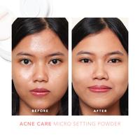 Gambar Sea Makeup Bundle Sea Make Up Acne Cover Cushion + Setting Powder - Fawn+SP dari Sea Makeup undefined 5 Tokopedia
