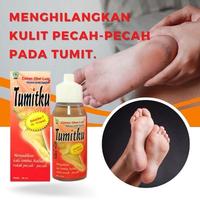 Gambar tumitku 30ml obat kaki mengatasi kaki pecah dari Ayuneskincare undefined 1 Tokopedia