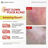 Gambar SOMETHINC ACNE SHOT AC Overnight Treatment Spot Cream - 10gr dari Somethinc undefined 2 Tokopedia