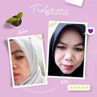 Gambar Pharmaskin Night Treatment Flek Series dari Pharmaskin Solution id undefined 3 Tokopedia