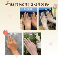 Gambar SKINDIFA GLUTA MILK BODY SERUM PEMUTIH BADAN BPOM dari SKINDIFA undefined 1 Tokopedia