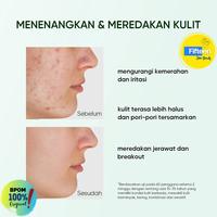 Gambar Skintific Mugwort Anti Pores & Acne Clay Stick - U/ jerawat & breakout dari Fifteen Beauty undefined 3 Tokopedia