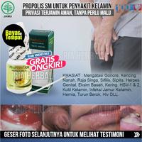 Gambar Obat Gatal Kemaluan Laki Laki Tradisional,Penghilang Gatel Pada Herpes dari Ria Herbal Official undefined 1 Tokopedia