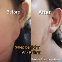 Gambar TERBUKTI AMPUH Salep SP Ar Raihan Salep Racikan Dokter Obat Benjolan - Salep dari @Herbal Keraton undefined 4 Tokopedia