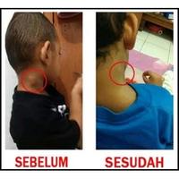 Gambar TERBUKTI AMPUH Salep SP Ar Raihan Salep Racikan Dokter Obat Benjolan - Salep dari @Herbal Keraton undefined 5 Tokopedia