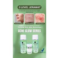 Gambar Day cream acne Glow Sunscreen Acne by Glowderm untuk kulit berjerawat dari Glowderm Product_NEW undefined 3 Tokopedia