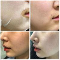 Gambar Images Masker Wajah Korea Hidrating Sheet Mask Melembabkan Wajah dari Queenshopid undefined 3 Tokopedia