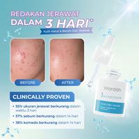 Gambar Share: Wardah Acnederm Acne Care Serum 15ml dari VIP_Mall undefined 4 Tokopedia