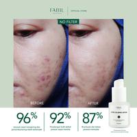 Gambar Acne Calming Serum dari Fabil Natural undefined 4 Tokopedia