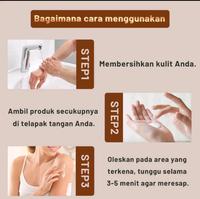 Gambar Salep Vitiligo Sumifu Ampuh Menghilangkan Bercak Putih Pada Kulit dari win seven shop undefined 3 Tokopedia
