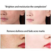 Gambar Cindynal Salep Cream Jerawat Penghilang Flek Hitam Bintik Beruntusan dari win seven shop undefined 5 Tokopedia
