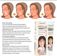 Gambar Salep Vitiligo Sumifu Ampuh Menghilangkan Bercak Putih Pada Kulit dari win seven shop undefined 4 Tokopedia