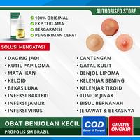 Gambar Obat Pengempis Daging Jadi Kutil Daging Tumbuh Di Leher Skin Tag PSM dari Iki Herbal undefined 1 Tokopedia