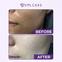 Gambar SERUM BB GLOW SULAM BEDAK - PEMUTIH KULIT SEJAK PEMAKAIAN PERTAMA PEMU - SPKT TANPA ALAT dari Solcare.id undefined 4 Tokopedia