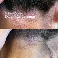 Gambar MISS DAISY Shampoo - Anti Rontok/Ketombe/Lempek - French Perfume - Rose Oud 8ml dari Global Beauty Shop undefined 4 Tokopedia