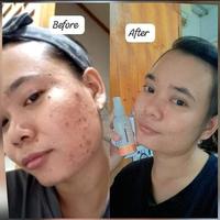 Gambar Paket hemat natura beauty spray dan aloevera original 100% dari Eka kurniati Natura undefined 5 Tokopedia