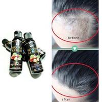 Gambar 100ml Minyak Kemiri Hitam Murni / Penumbuh Rambut Botak Rontok - Shampoo dari SIPmurahShopStore undefined 3 Tokopedia