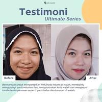 Gambar VARIAN TONER MS GLOW ORIGINAL GLOWING ACNE ULTIMATE LUMINOUS WHITENING - TONER ACNE dari Official MS Glow Store Indonesia undefined 3 Tokopedia