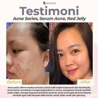 Gambar VARIAN TONER MS GLOW ORIGINAL GLOWING ACNE ULTIMATE LUMINOUS WHITENING - TONER ACNE dari Official MS Glow Store Indonesia undefined 4 Tokopedia